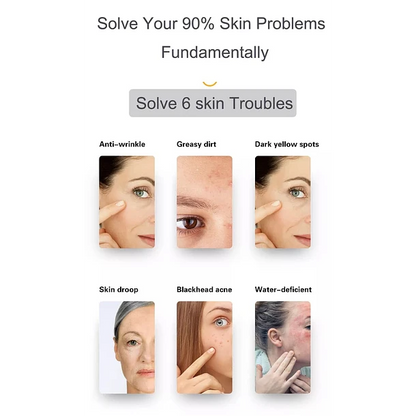 Equipo Hidrodermoabrasión para Belleza Facial - 6 en 1